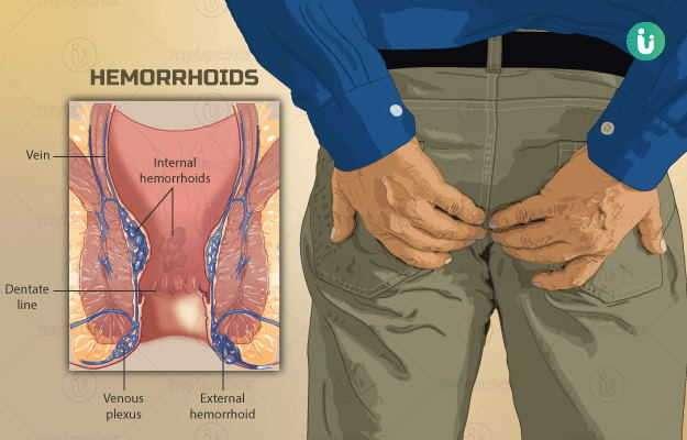 Ayurvedic, Alternative Therapy/ Medicine; Exp: More than 15 year
