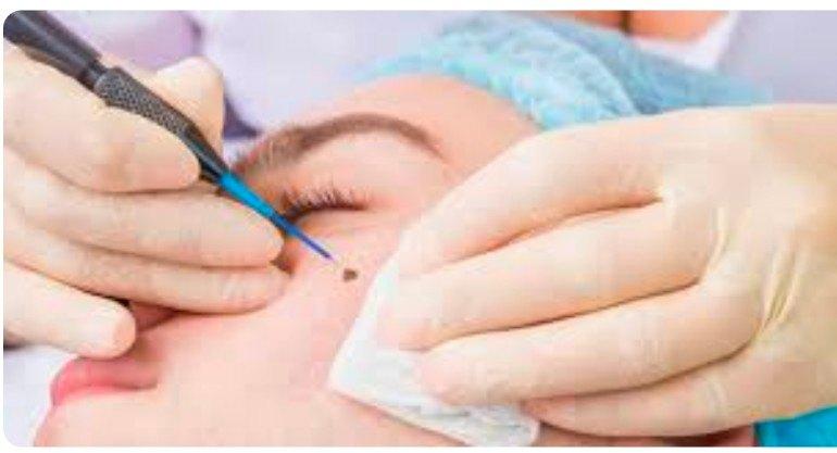 Dermatologist, Doctors; Exp: More than 15 year