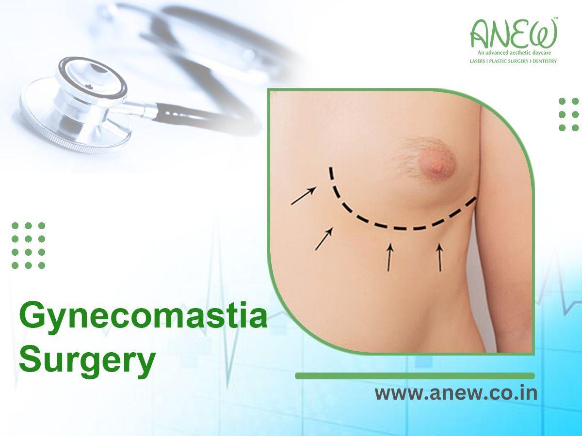 Cost-effective gynecomastia surgery in Bangalore, Karnataka - Anew