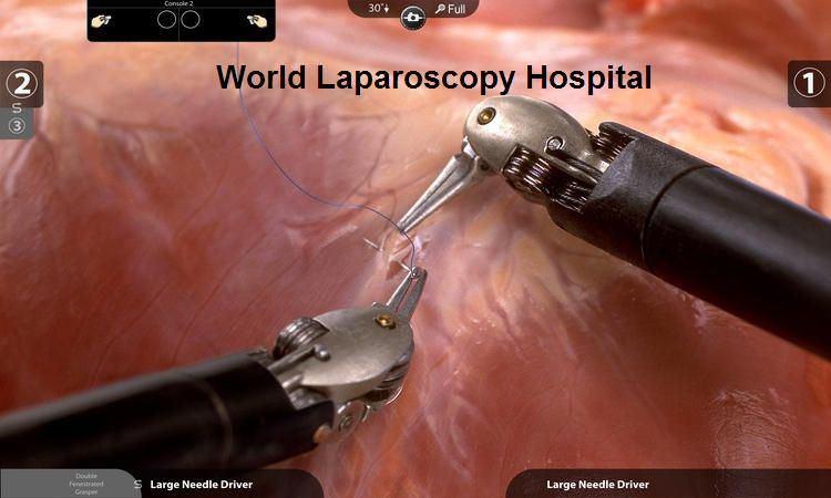 Integrated Diploma And Fellowship In Minimal Access Surgery