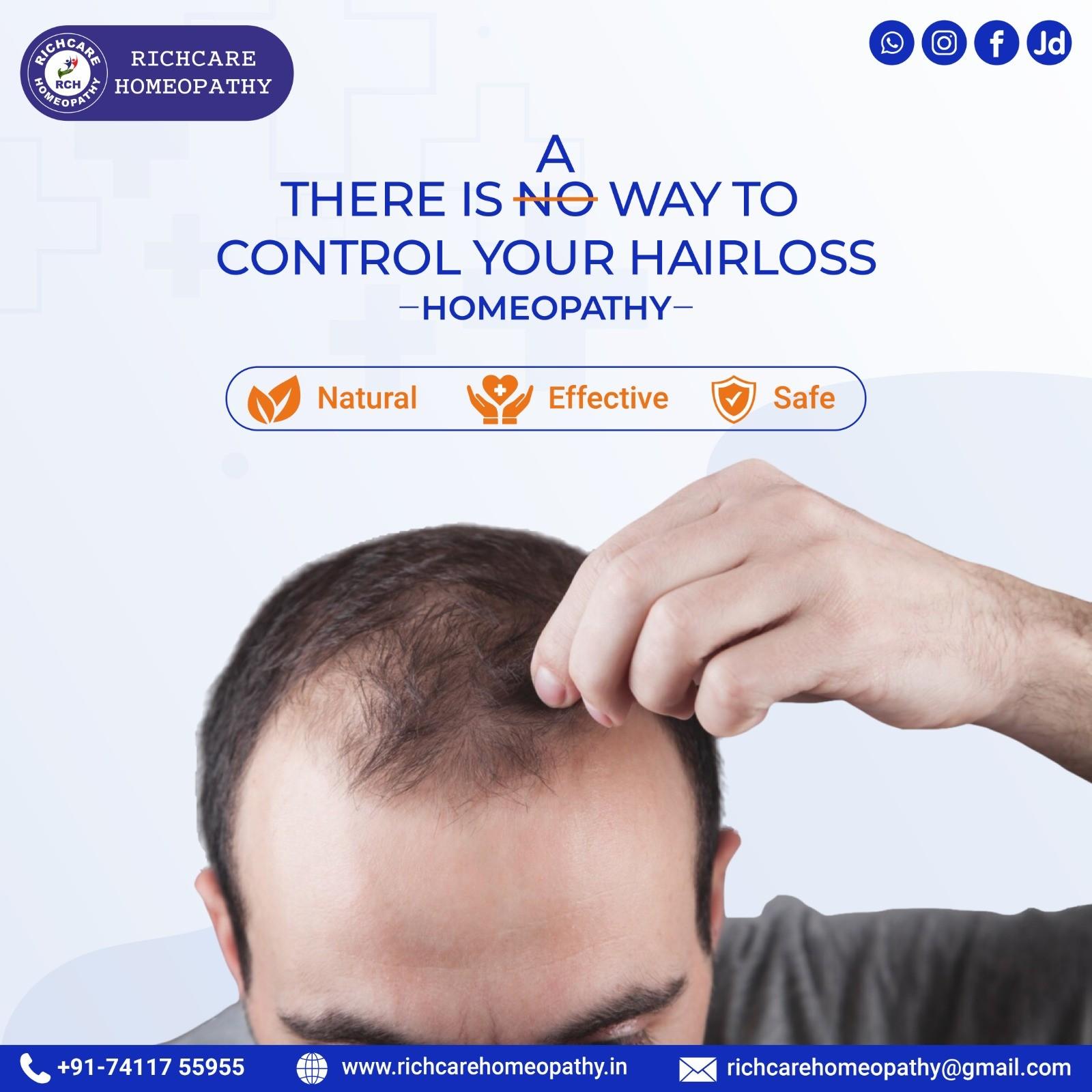 Hair fall Homeopathy treatment in Bangalore