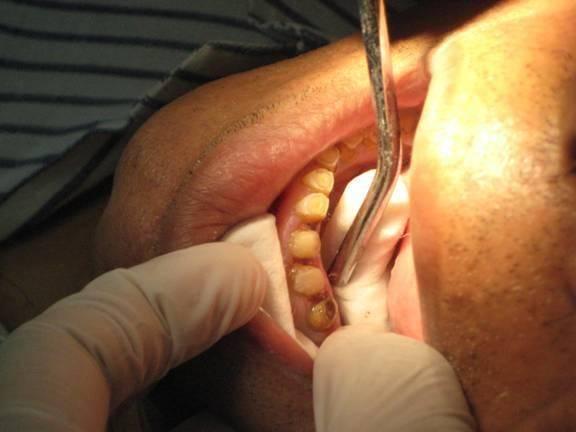 Best Laser Dentists in Ahmedabad | Aashu dental | 9825158578