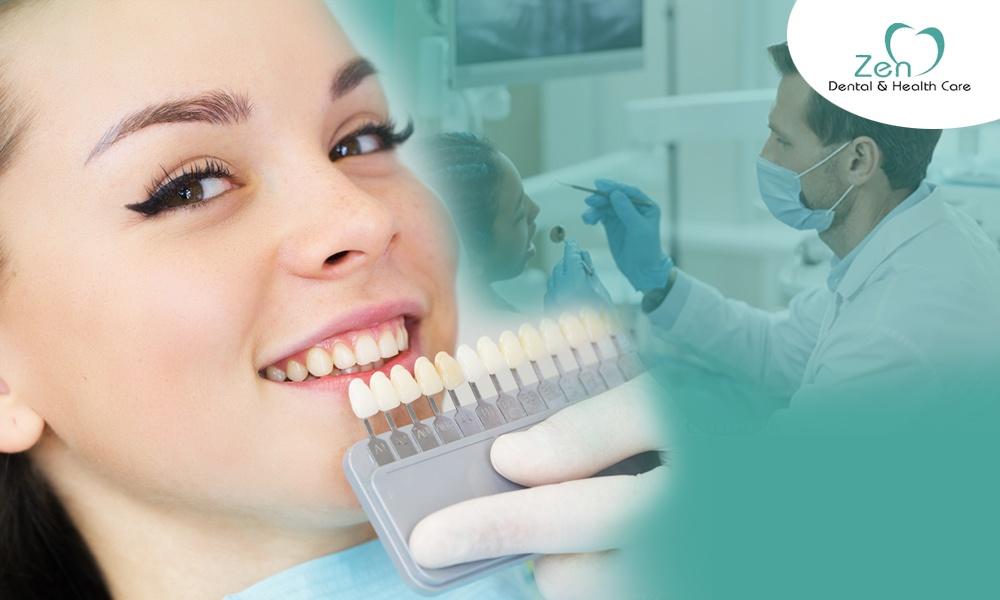 Best Cosmetic Dentist Service In Sarjapur Road Bangalore