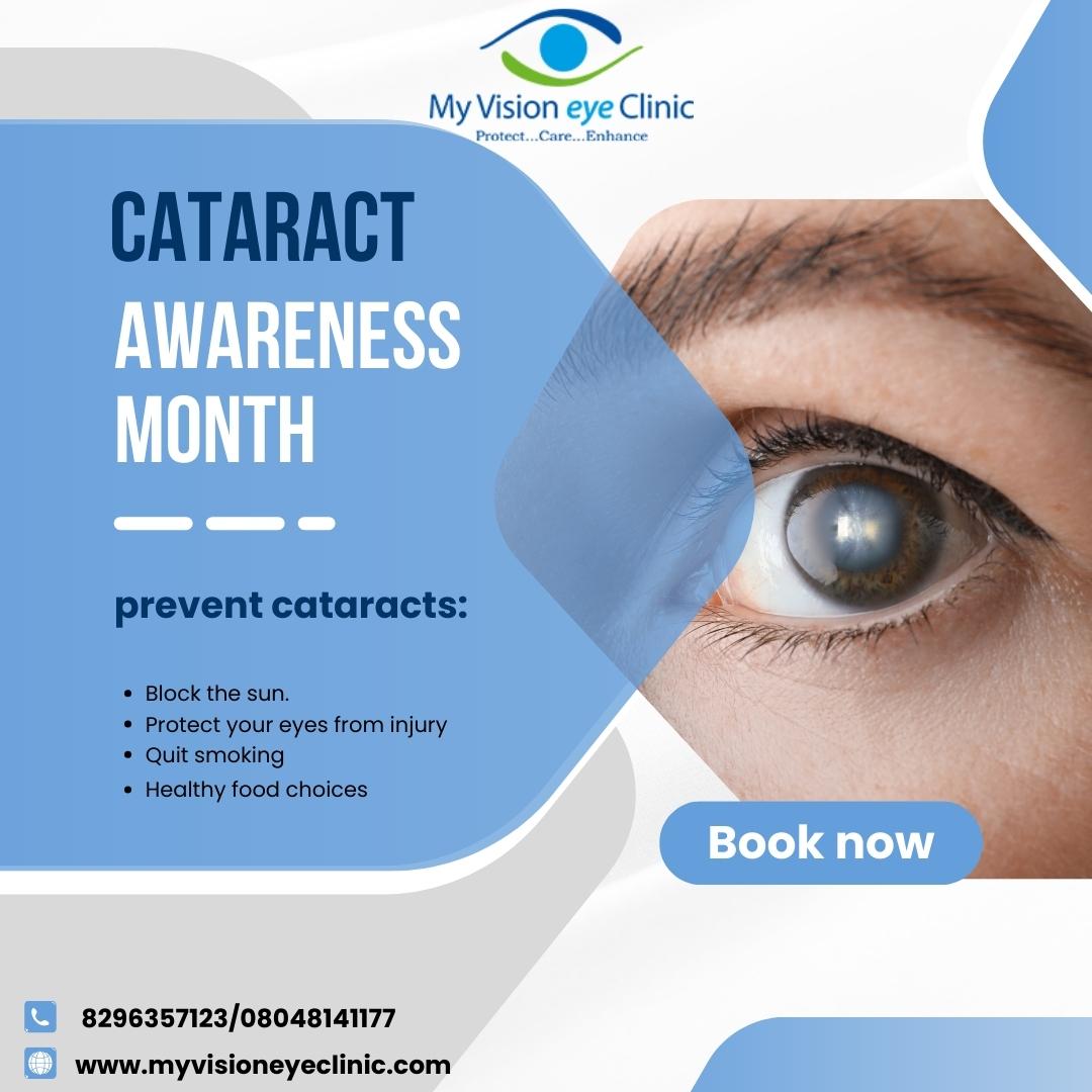  eye care services in Bangalore 