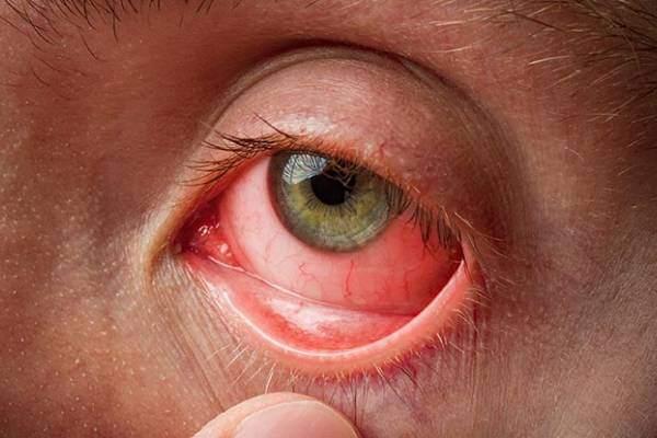 Best Eye Hospital in Wakad, Pune						