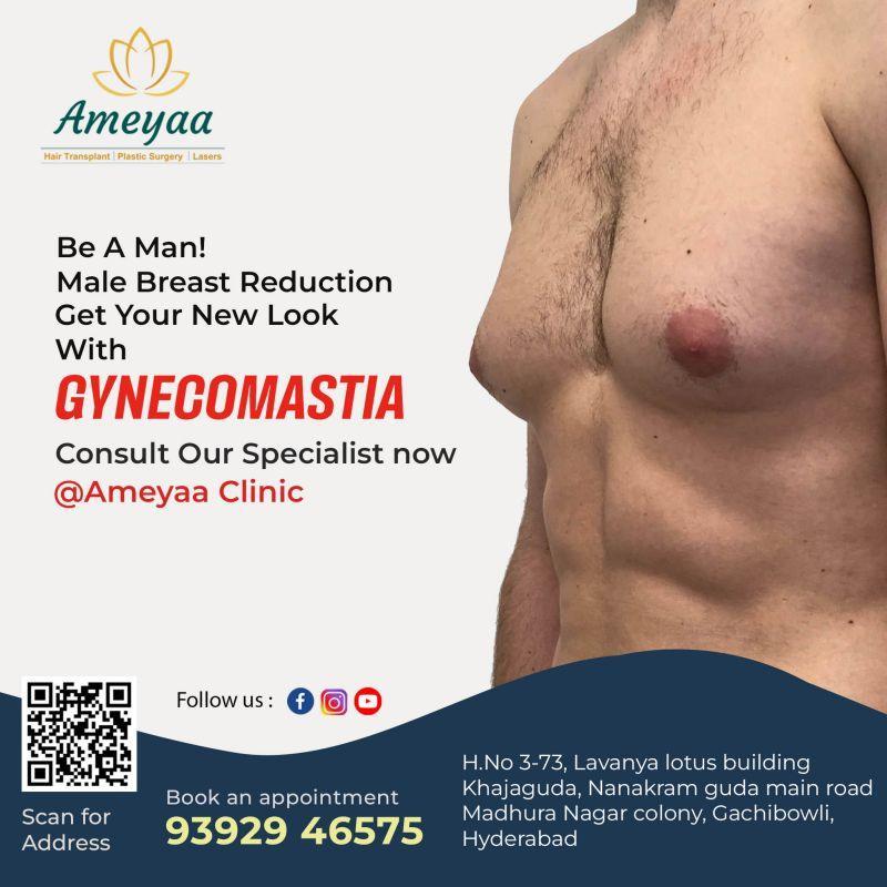  Gynecomastia treatment in Hyderabad | Gachibowli