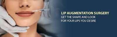Lip augmentation treatment | Gachibowli | Hyderabad