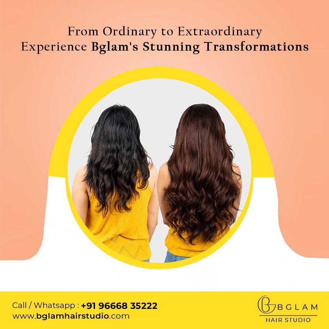 Non surgical hair replacement in bangalore