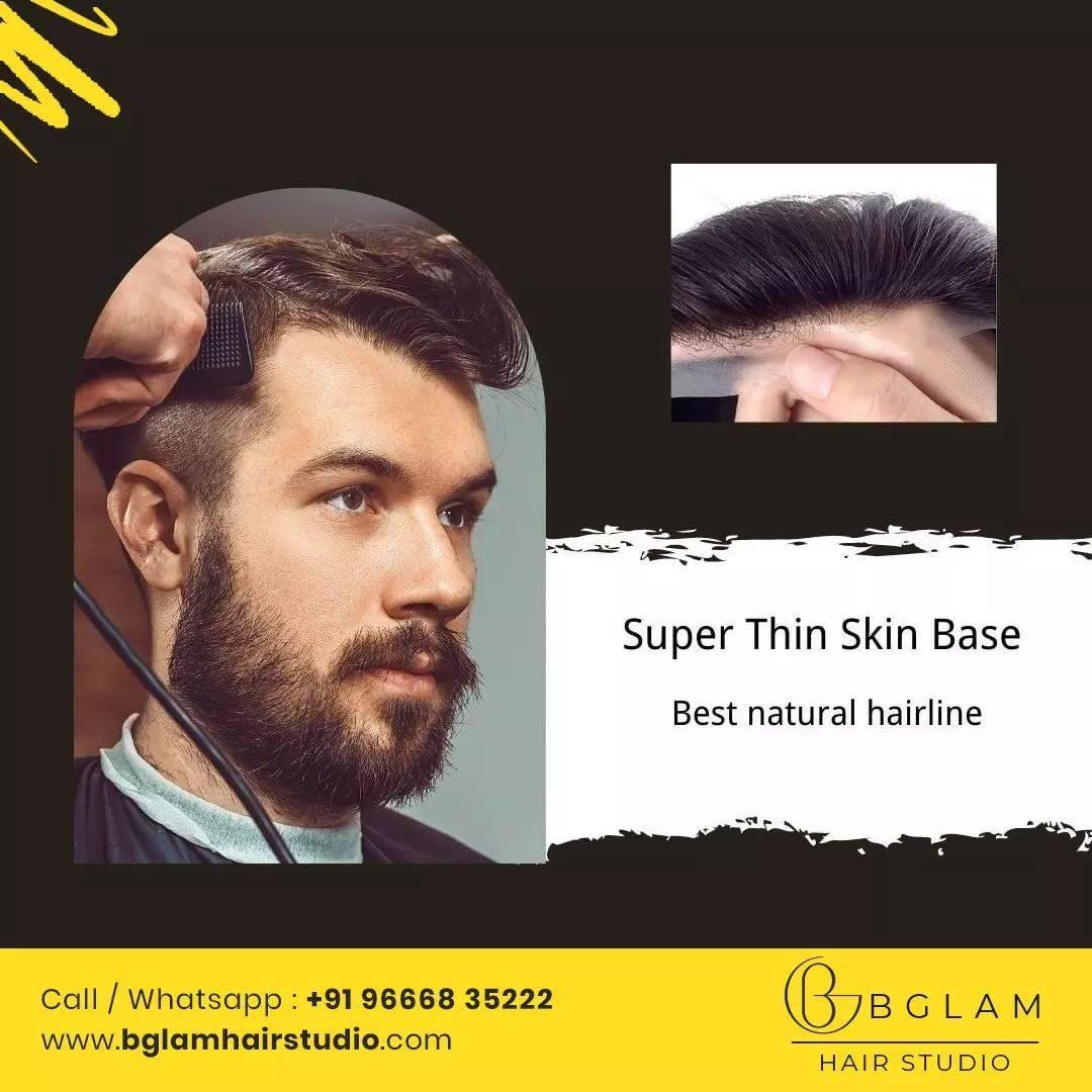 Non surgical hair replacement in hyderabad