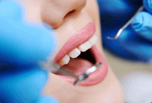 Finding the Best Dentist in Gurgaon Your Complete Guide