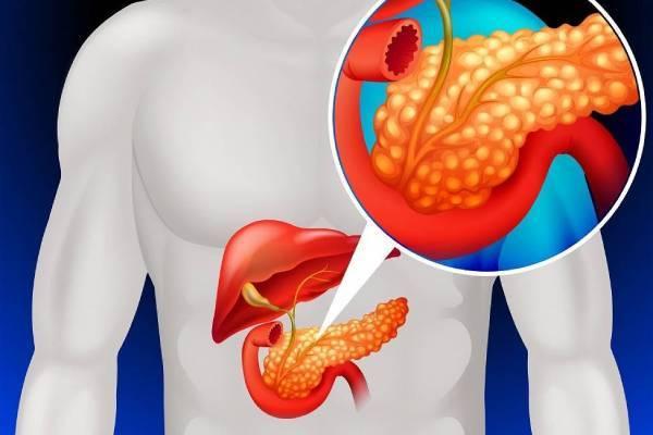 Specialist HPB Surgeon in Hyderabad - Dr. MSS Keerthi 