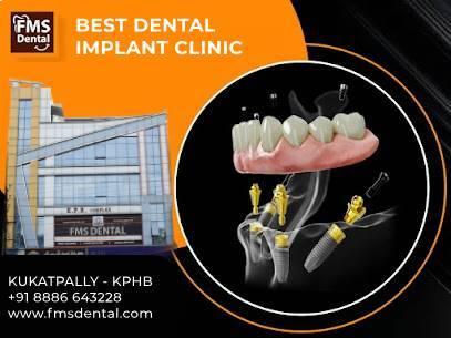 Best Dental Clinic In Kukatpally