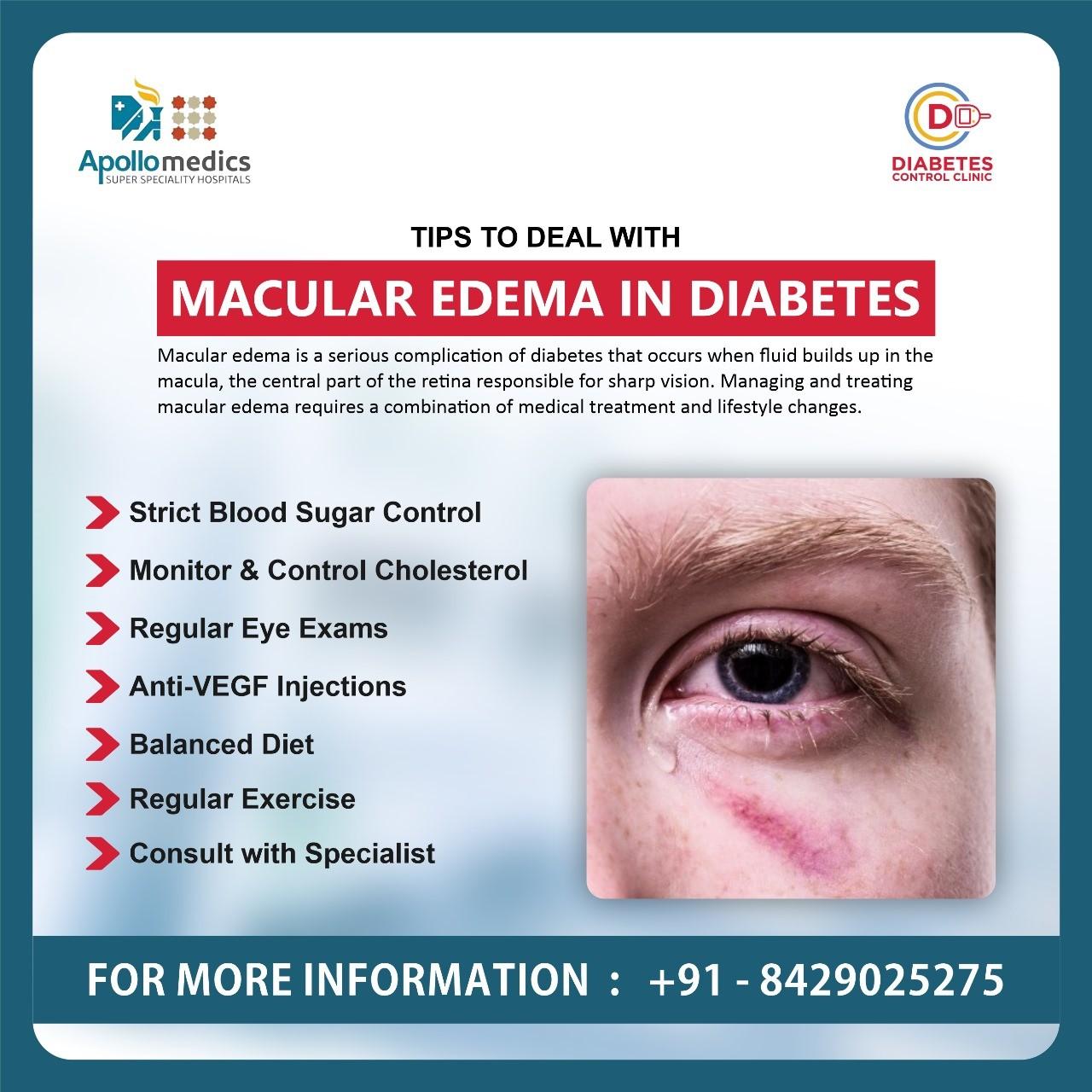 Diabetologist Doctor in Lucknow 