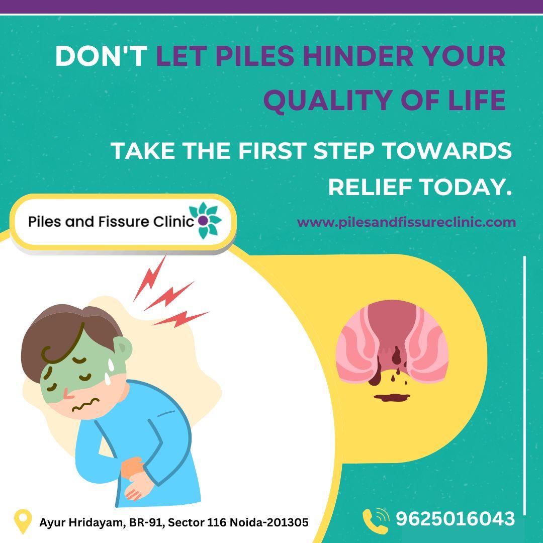 Piles Treatment in Delhi | Expert Care & Advanced Solutions