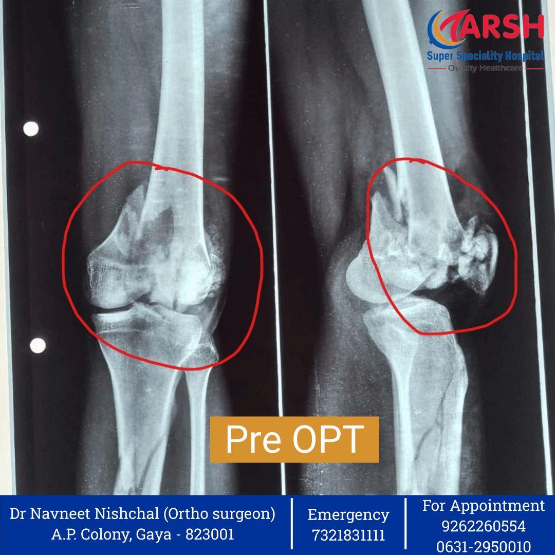 Orthopedic Doctor in Gaya