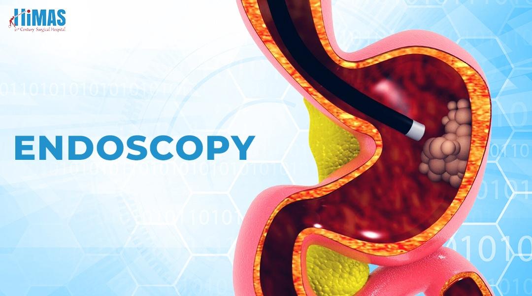 Top Endoscopy Treatment Services at Himas Hospital