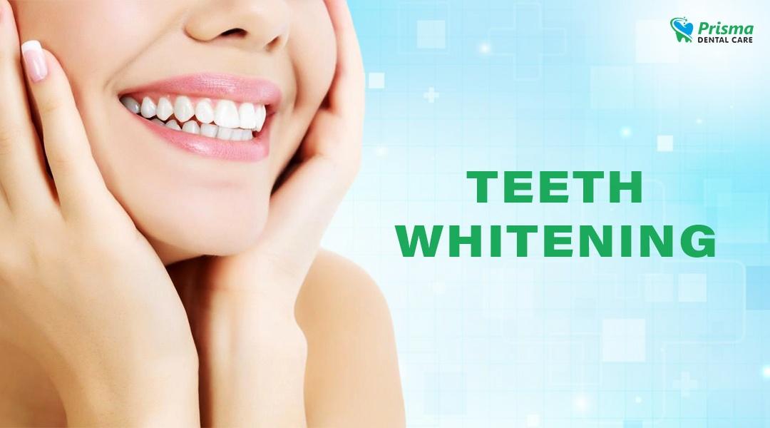 Best Teeth Whitening Services at Prisma Dental Care in Konanakunte Bengaluru 