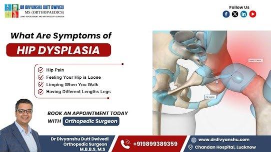 Symptoms of Hip dysplasia by Dr. Divyanshu Dutt Dwivedi