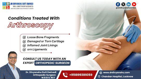 Arthroscopy surgery in Lucknow | Dr. Divyanshu Dutt Dwivedi