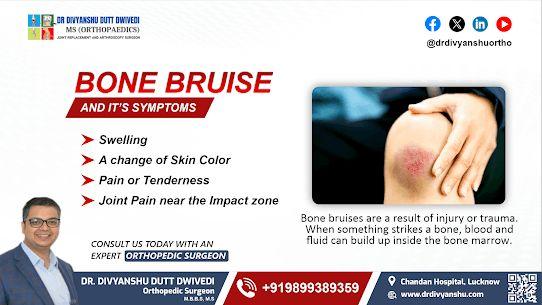 Bone Bruise and its Symptoms by Dr. Divyanshu Dutt Dwivedi