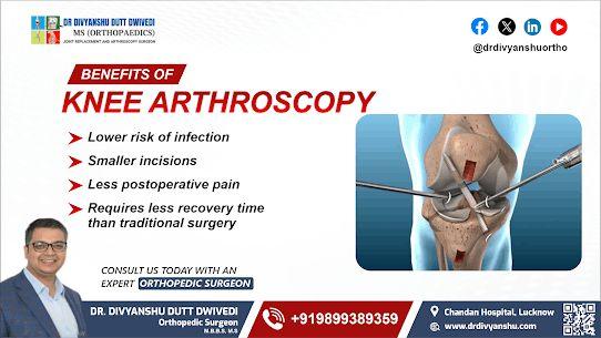 Benefits of Knee  Arthroscopy by Dr Divyanshu Dutt Dwivedi