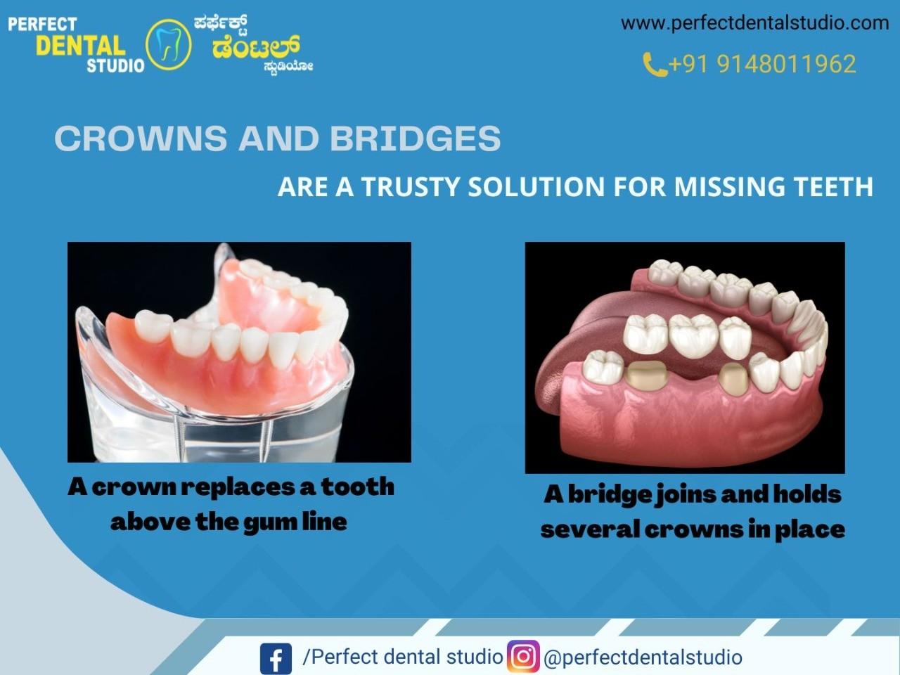 Perfect Smile with Crowns and Braces at Perfect Dental Studio