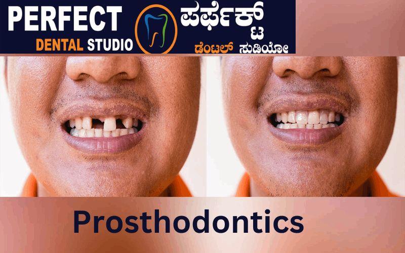 Prosthodontics in BTM Layout, Bangalore: Perfect Dental Studio