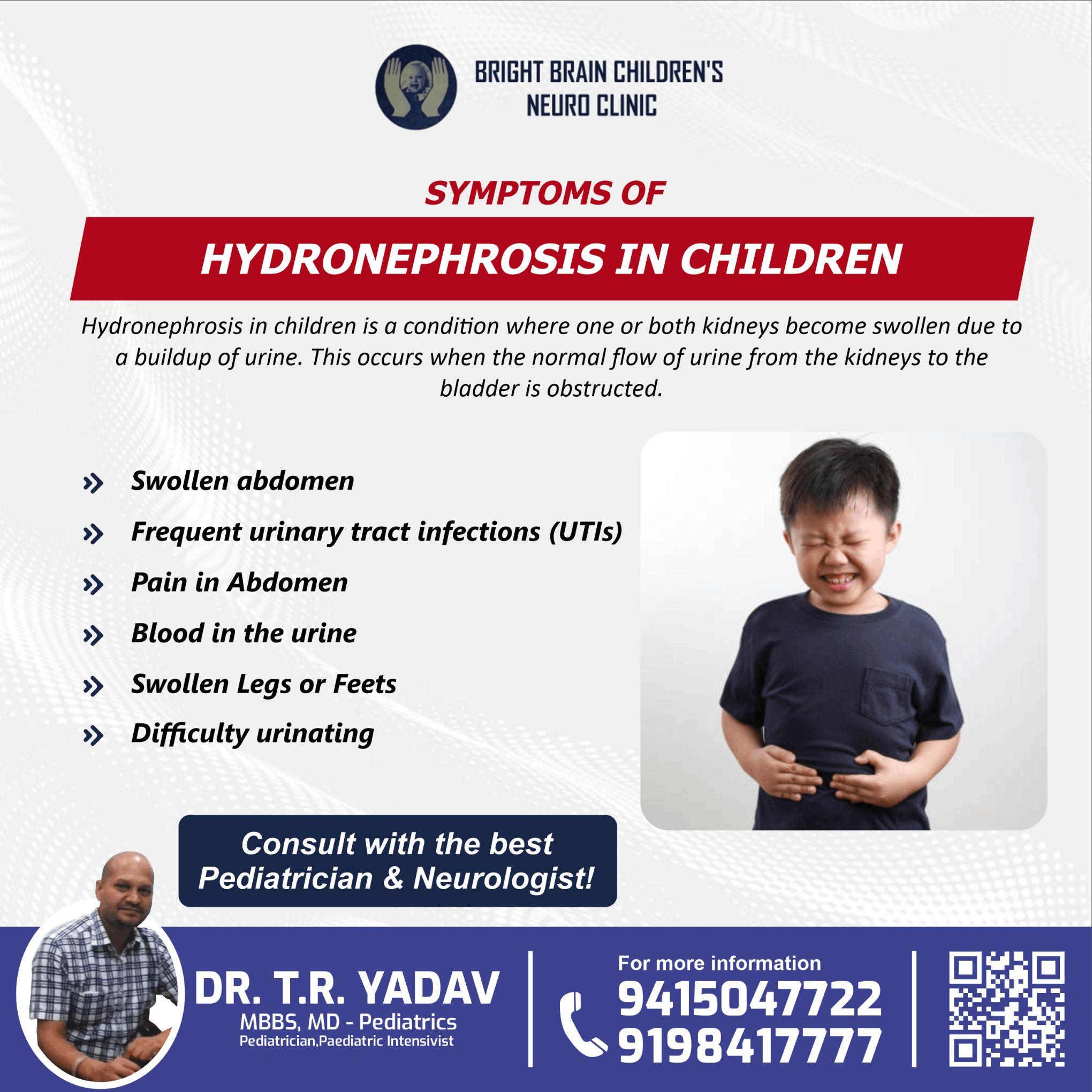  Symptoms of Hydronephrosis in Children | Dr. T R Yadav