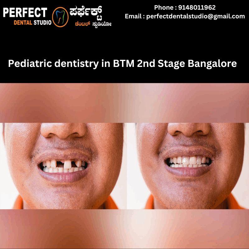 Smile Design and Padiatric Dentistry in BTM 2nd Stage Bangalore at PDS