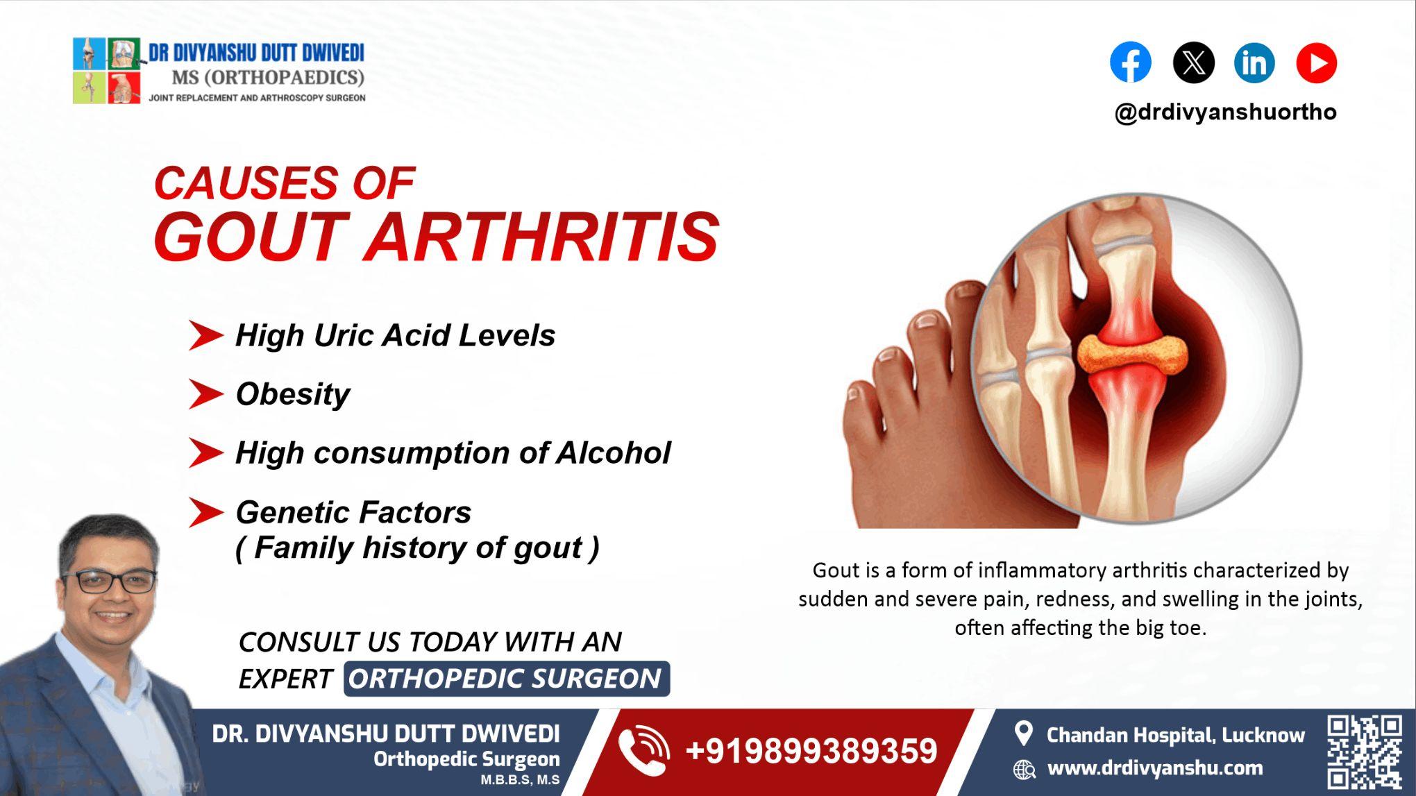 Gout Arthritis Treatment in Lucknow | Dr. Divyanshu Dutt Dwivedi