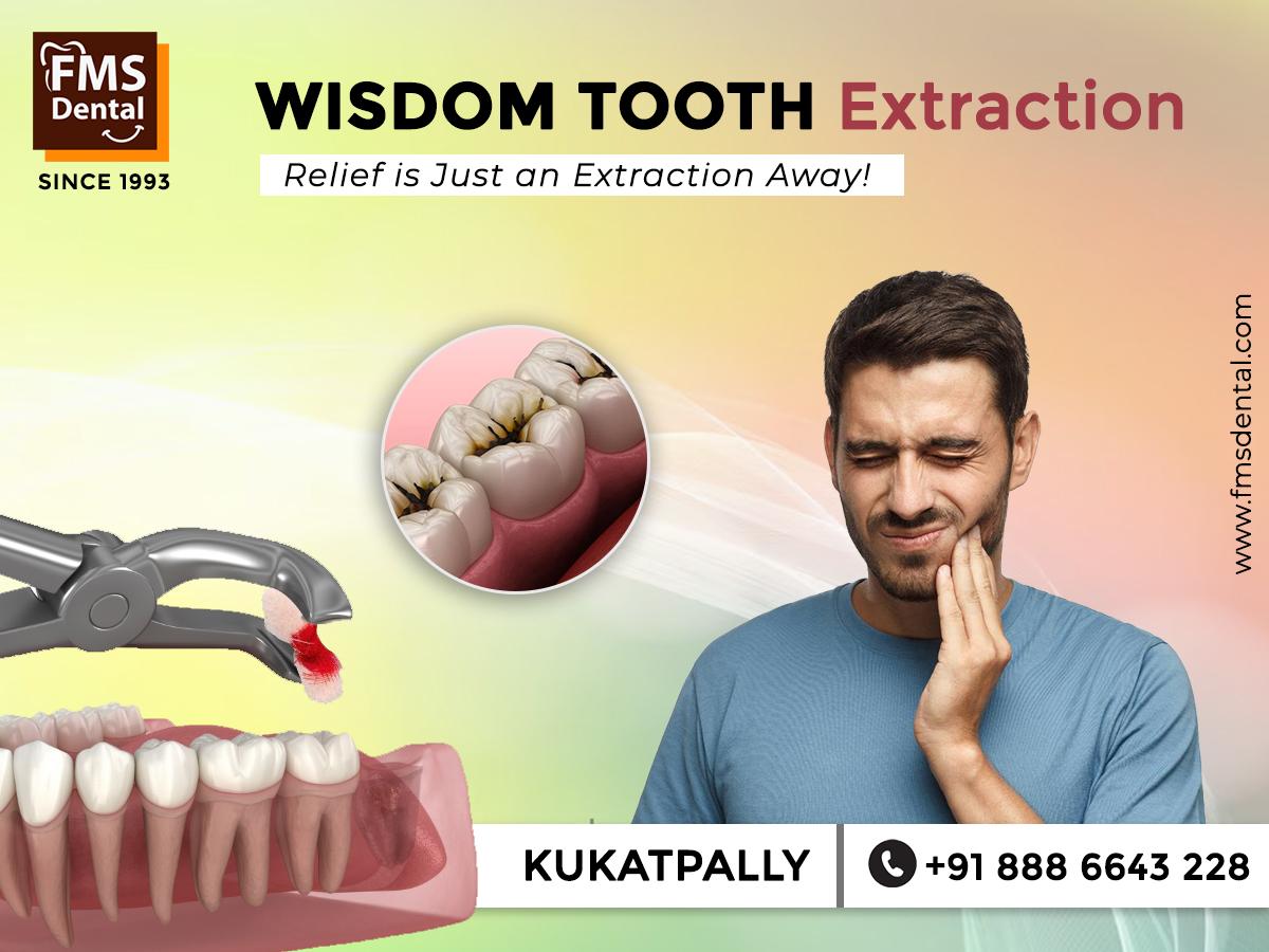 Wisdom Tooth Extraction at FMS Dental Hospital, Kukatpally (KPHB)