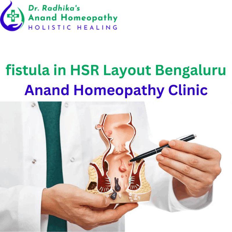 Best Fistula in HSR Layout Bengaluru -Anand Homeopathy Clinic