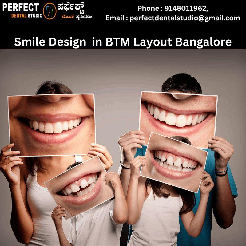 Best Smile Design in BTM Layout Bangalore Perfect Dental Studio