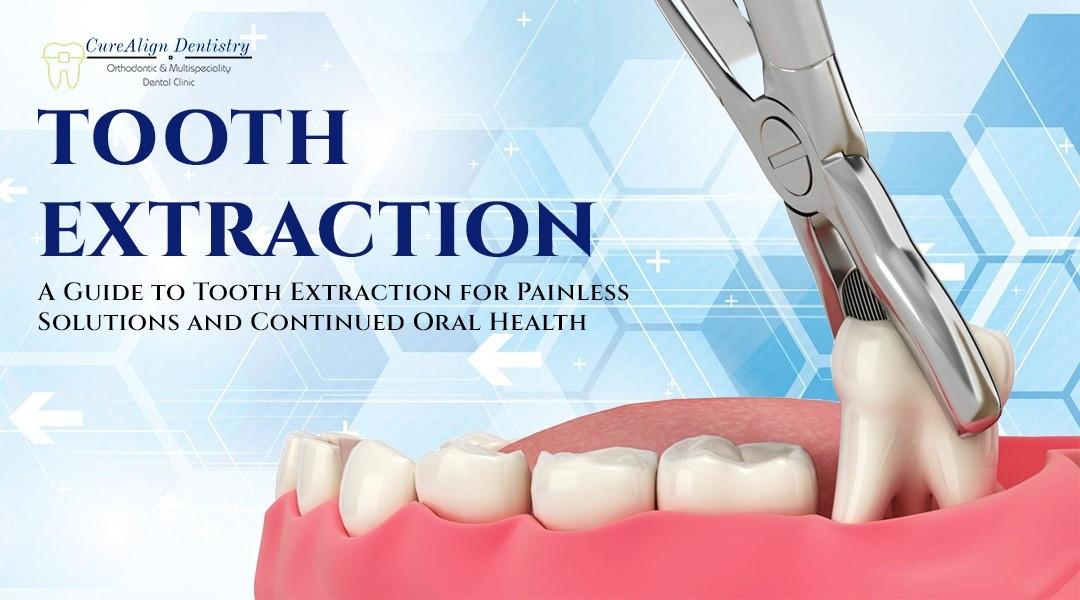 Tooth Extraction in Hennur, Bangalore at CureAlign Dentistry