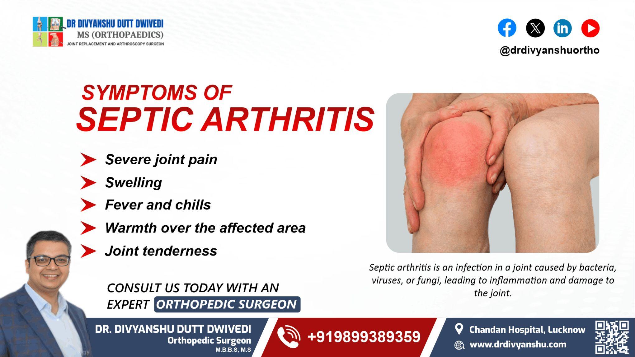 Consult the Best Knee Replacement Surgeon in Lucknow | Dr. Divyanshu Dutt 