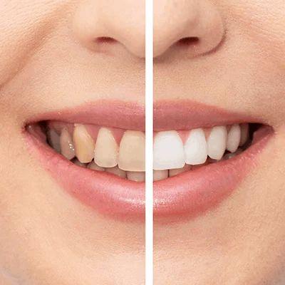 Best Dental Clinics in Madhapur