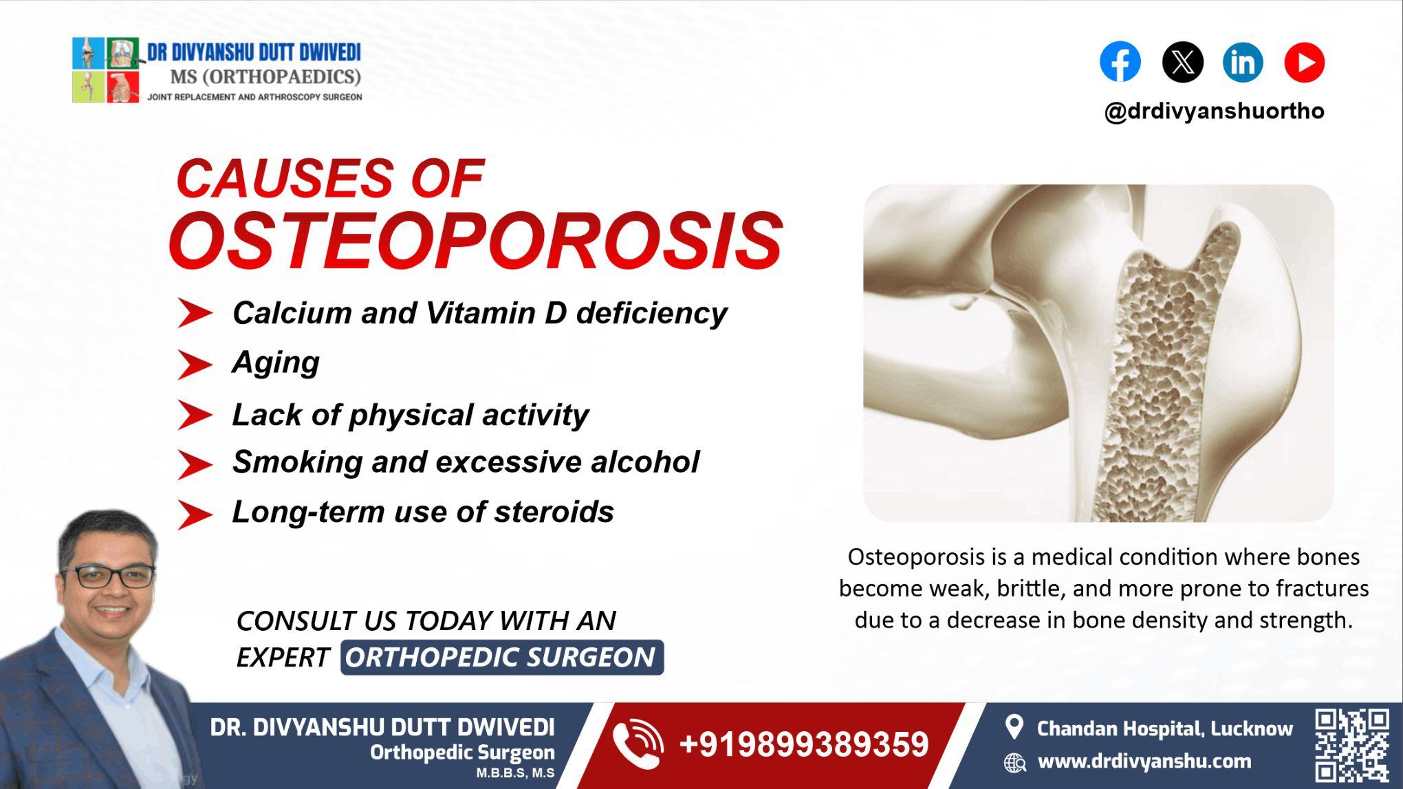 Cause of Osteoporosis | Dr. Divyanshu Dutt Dwivedi