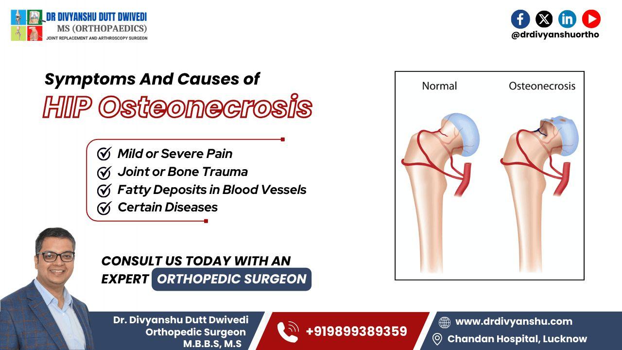 Symptoms and Causes of Hip Osteonecrosis | Dr. Divyanshu Dutt Dwivedi