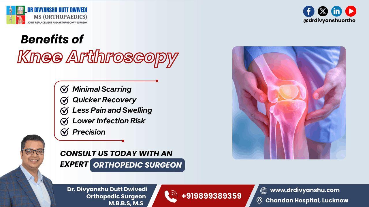 Benefits of Knee Arthroscopy | Dr. Divyanshu Dutt Dwivedi