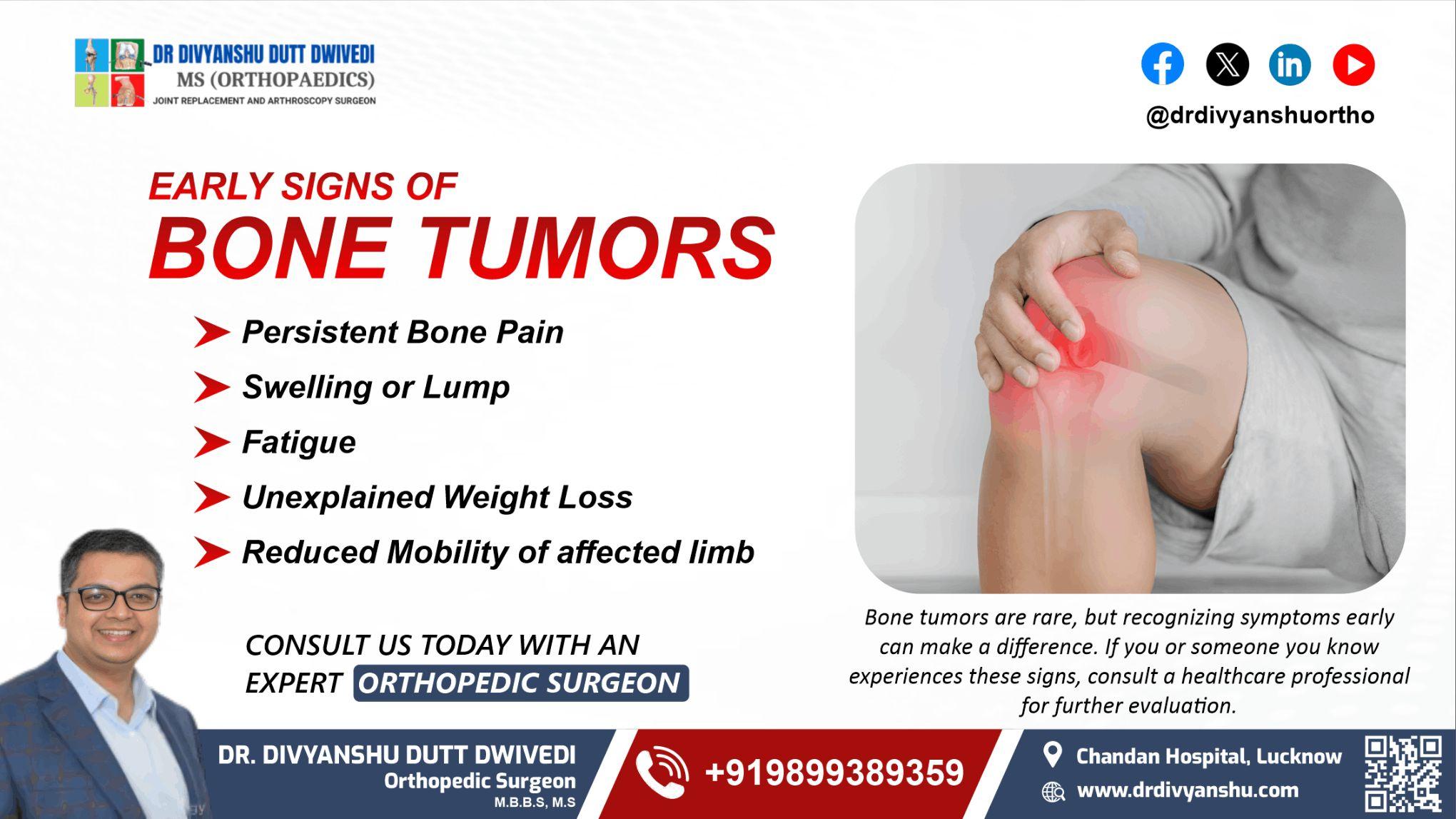 Early Signs of Bone Tumours | Best Orthopedic Doctor in Lucknow - Dr. Divyanshu