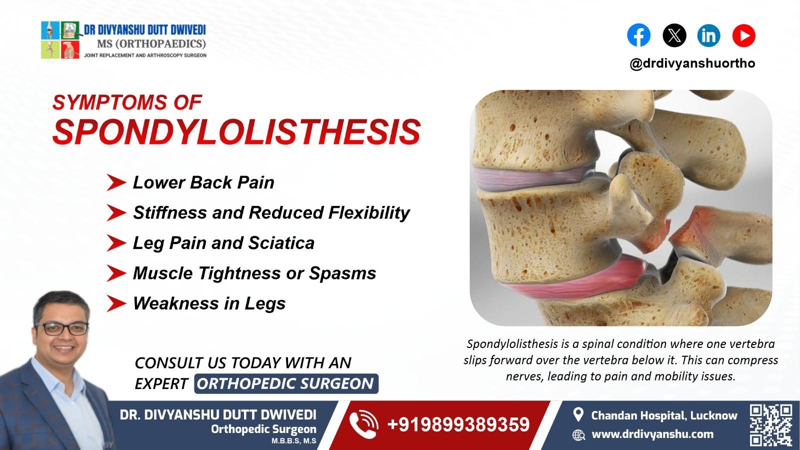 Symptoms of Spondylolisthesis by Dr. Divyanshu Dutt Dwivedi