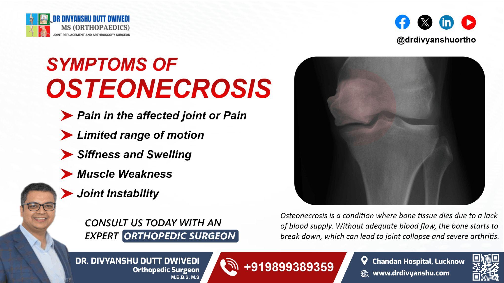 Symptoms of Osteonecrosis | Dr. Divyanshu Dutt Dwivedi