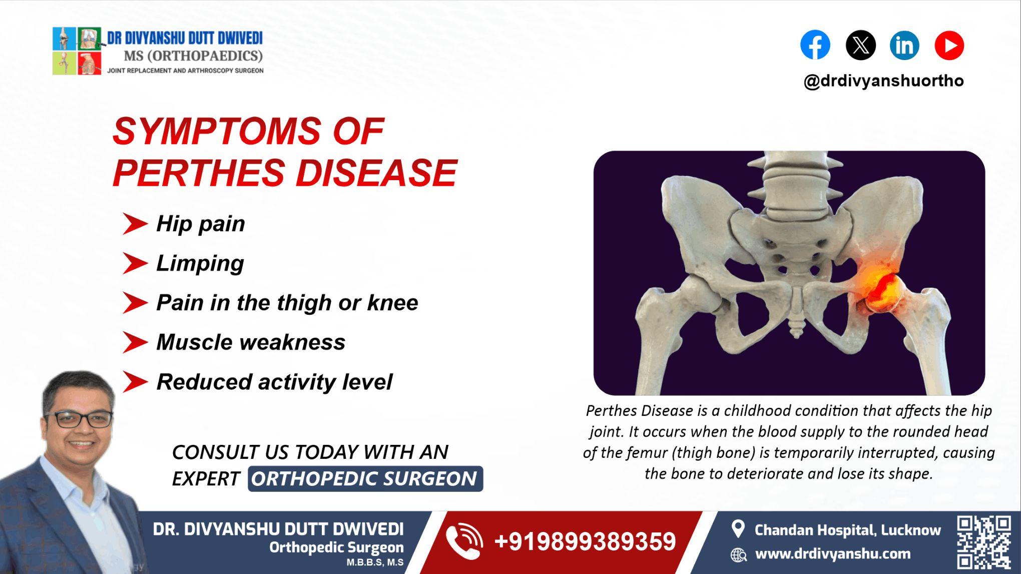 Symptoms of Perthes Disease | Dr. Divyanshu Dutt Dwivedi
