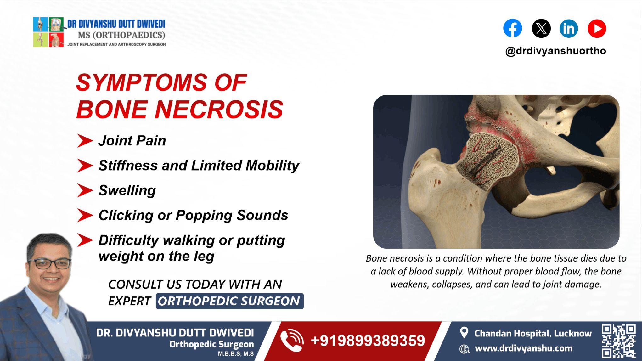 Symptoms of Bone Necrosis | Dr. Divyanshu Dutt Dwivedi