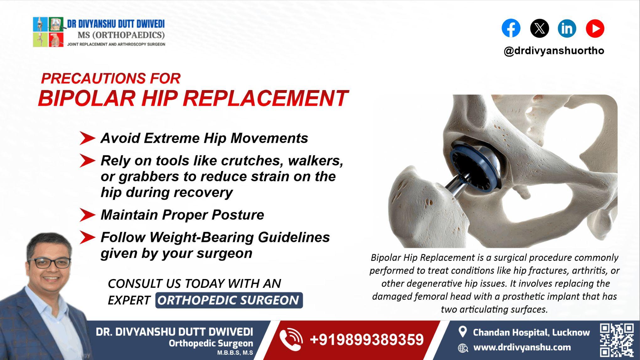 Bipolar Hip Replacement in Lucknow | Dr. Divyanshu Dutt Dwivedi