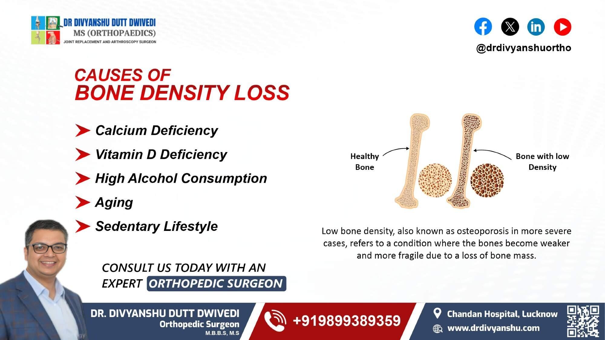 Strengthen Your Bones with Dr. Divyanshu Dutt