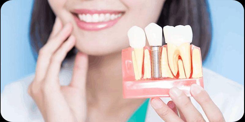 Expert Dental Implants for Seniors at The Smile Spa 