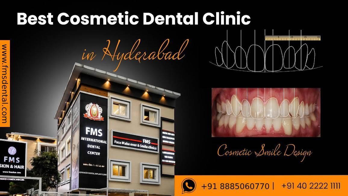 FMS Cosmetic Dental Clinic - Best Dental Clinic in Jubilee Hills, Hyderabad