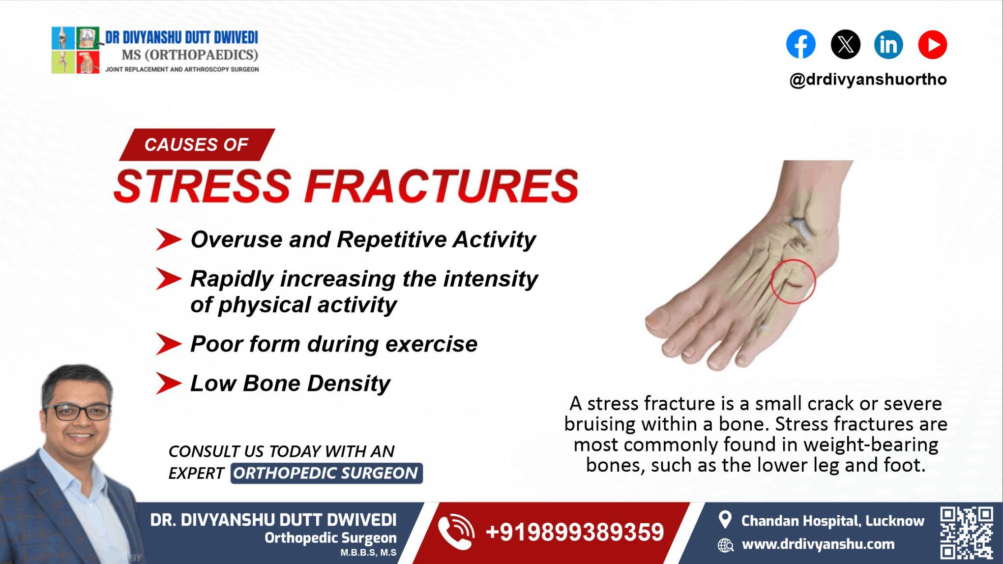 What are stress fractures ?