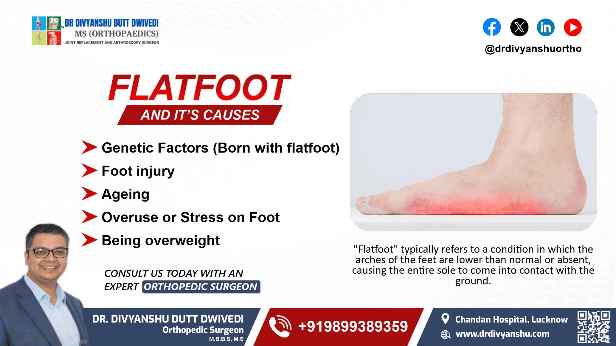 Flatfoot and Its Causes 